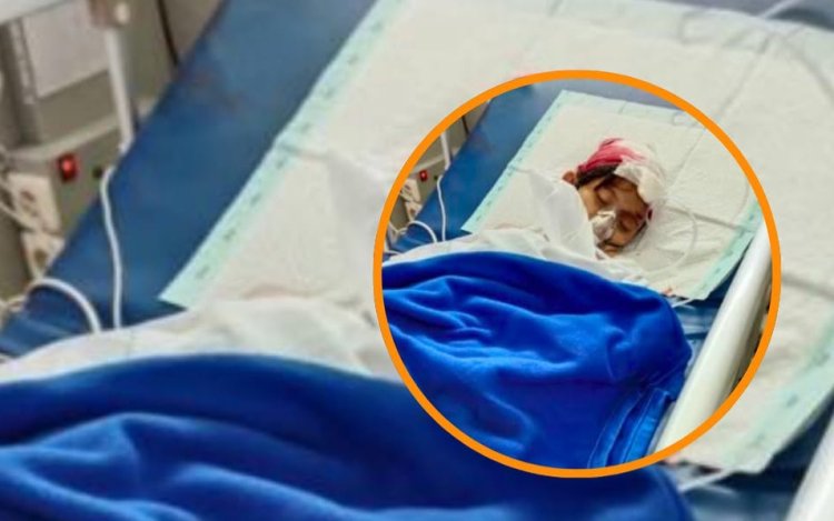 Viral Siswi SD di Tangerang Dibacok Orang Tak Dikenal: Polisi Bantah Pembegalan