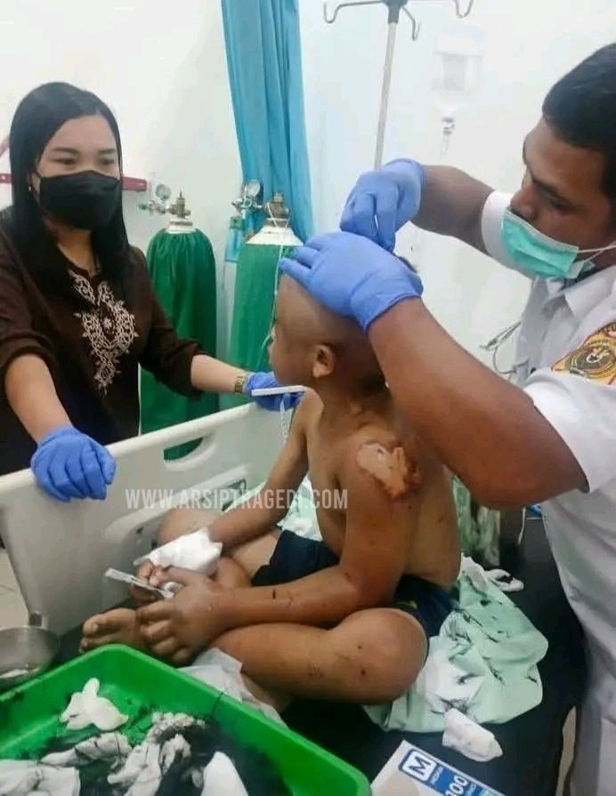 Anak Diduga Korban Kekerasan Ditemukan di Sidikalang, Polisi Diminta Bertindak