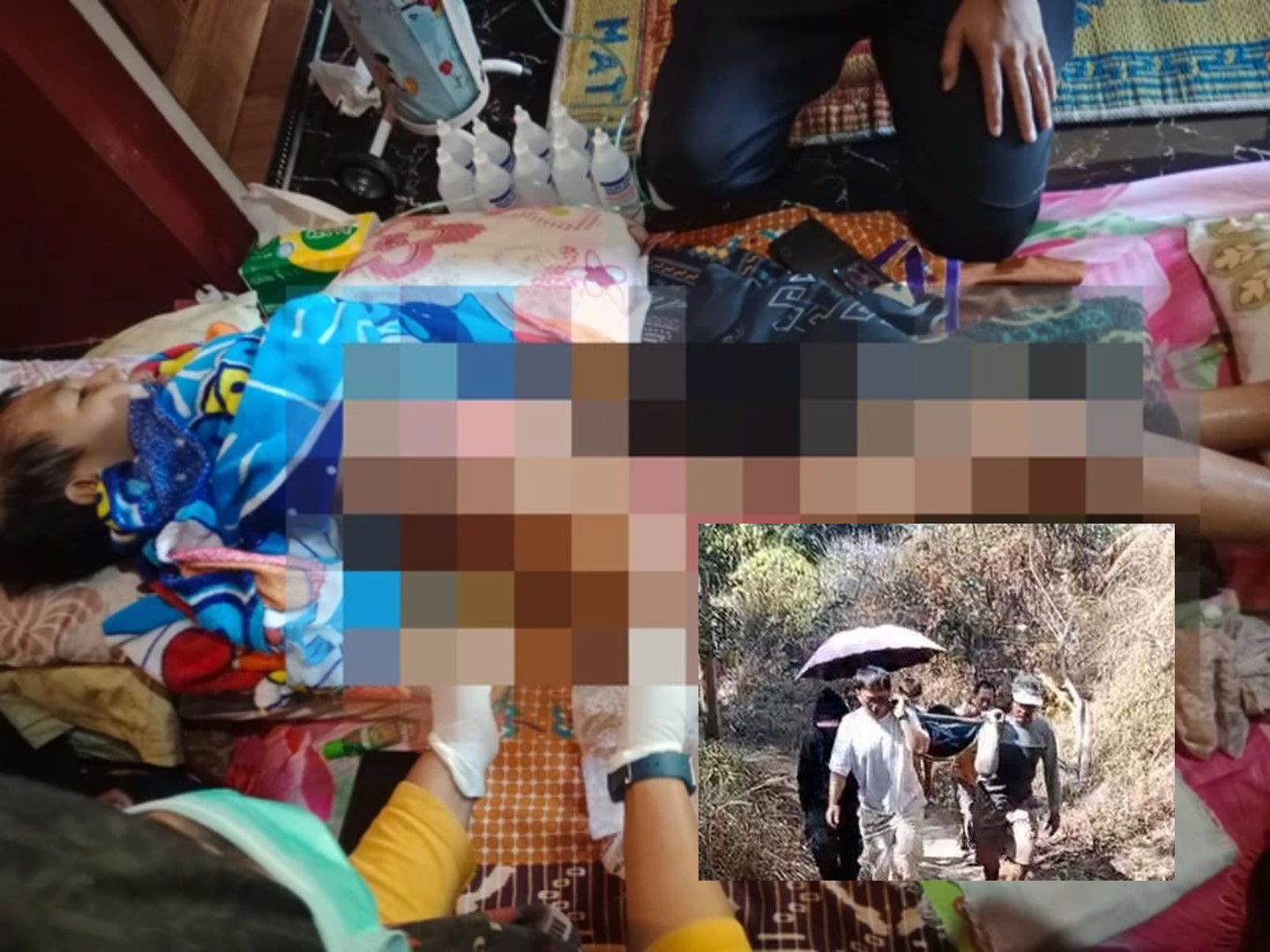 Kisah Pilu Dua Remaja Cianjur Terpaksa Ditandu Puluhan Kilometer Demi Berobat, Jalan Rusak dan Keterbatasan Akses Jadi Kendala