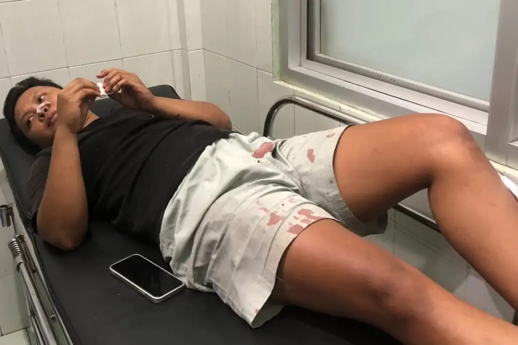 Geger di Boyolali, Tukang Tambal Ban Ditembak OTK Lima Kali Saat Sedang Tiduran